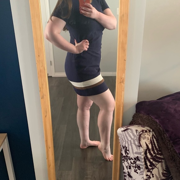 Tommy Hilfiger Short Sleeve Dress with Suede Details - Picture 2 of 7